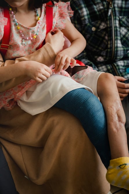 a close up of a girl’s injured leg