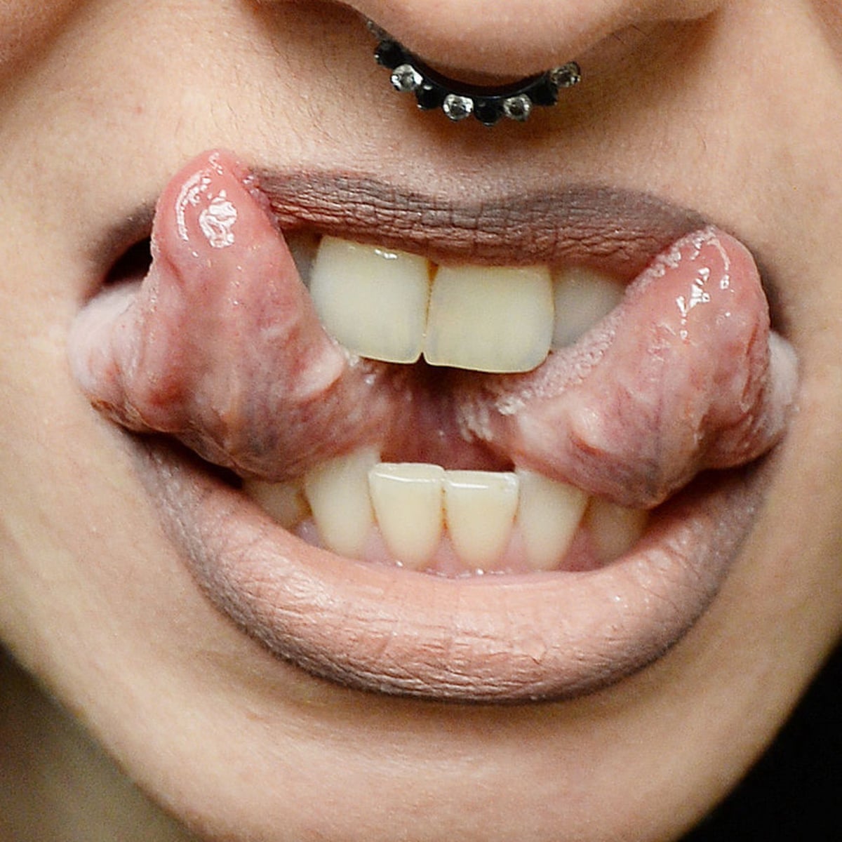 Tongue Splitting Poses Serious Risk To Health Say Surgeons Society The Guardian
