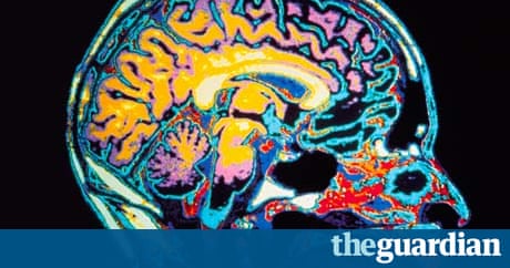 City Living Affects Your Brain Researchers Find Science