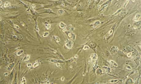 (FILES) Embryonic stem cells are picture