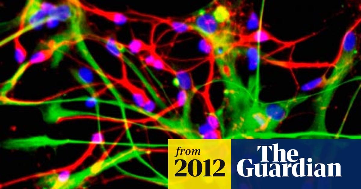 Memory Loss Can Begin From Age 45 Scientists Say Neuroscience The Guardian Memory Loss Can Begin From Age 45 Scientists Say Neuroscience The Guardian