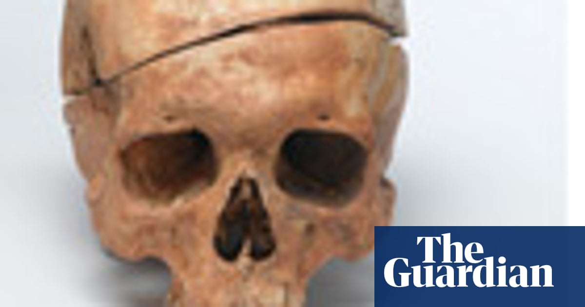 Donating Your Body To Science: A Beginner's Guide | Medical Research | The  Guardian