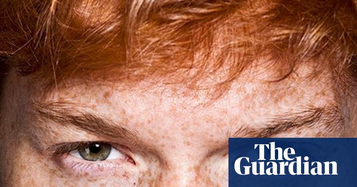 Damian Lewis and the case of the missing redheads | Photography | The  Guardian