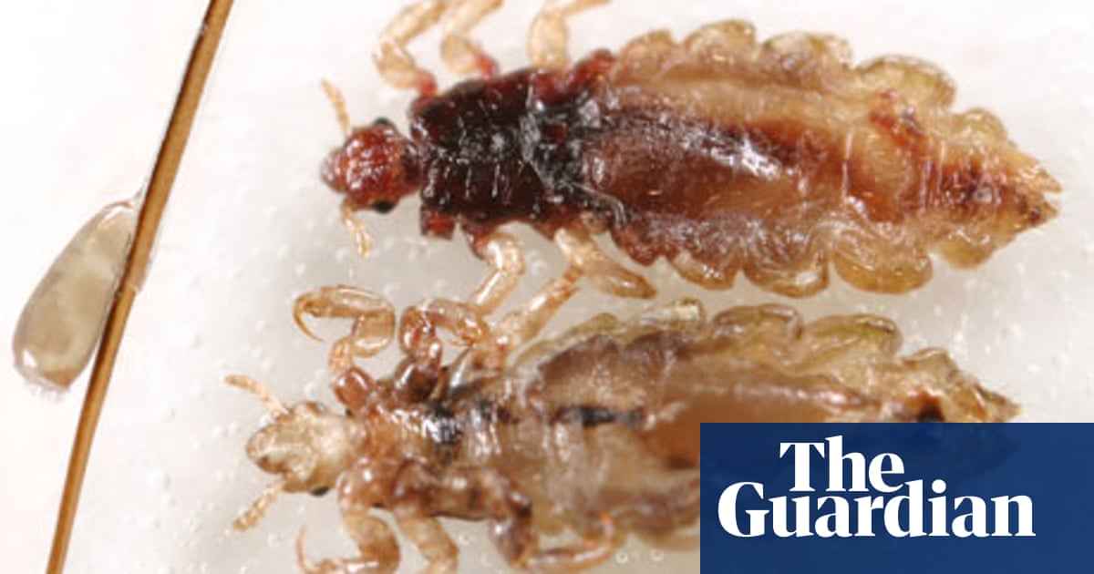 The Inside Track On Head Lice Health Wellbeing The Guardian The Inside Track On Head Lice Health Wellbeing The Guardian