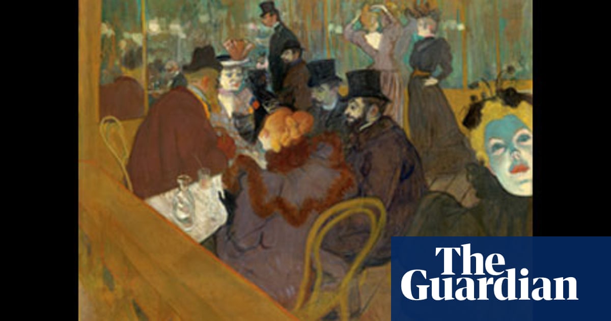 Toulouse Lautrec Syndrome Pictures Toulouse Lautrec Syndrome Pictures