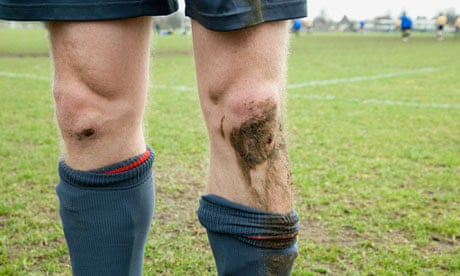 Footballer with cut and muddy knees