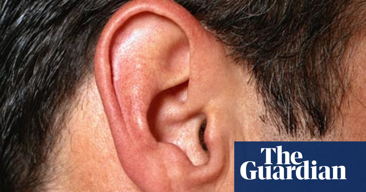 Improbable Research The Measurement Of Ears And Other Body