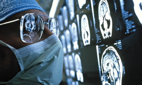 surgeon looking at brain scans