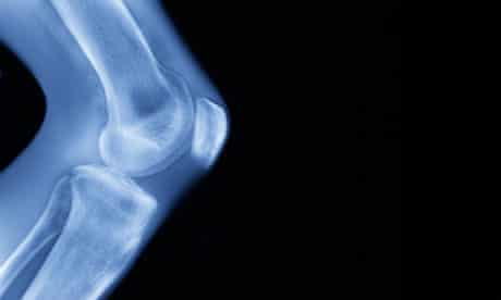 Bike blog: X-ray of human knee