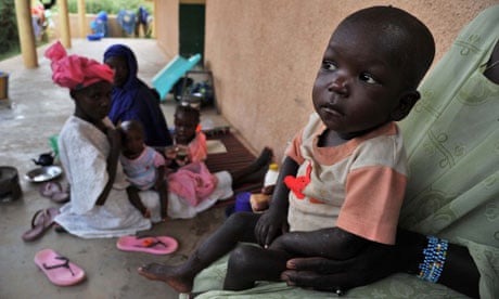 MDG : Malnutrition : children suffering from malnutrition at the Gao hospital, Mali