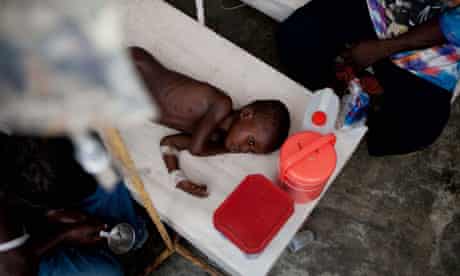 A boy receives treatment for cholera symptoms at a centre in Mirebalais, Haiti