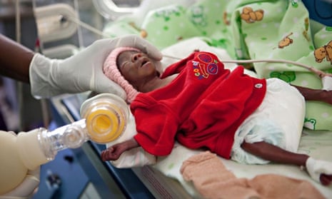 Neonatal and Infant Mortality Risk Best Predicted by Chest and