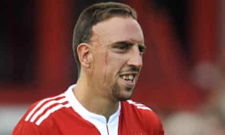 Franck Ribery Will Not Be Sold Claims Bayern S General Manager Uli Hoeness Franck Ribery The Guardian Franck Ribery Will Not Be Sold Claims Bayern S General Manager Uli Hoeness Franck Ribery The Guardian