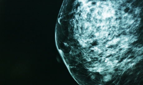 Scanning for breast cancer