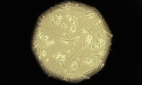 Embryonic stem cells seen through a microscope.