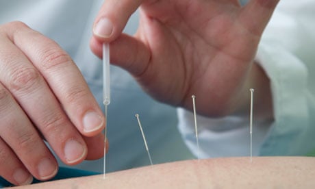 Acupuncture 'meridians' match main nerve pathways, scientists believe