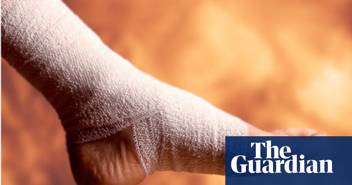 Dr Luisa Dillner's guide to . . . a sprained ankle | Health & wellbeing |  The Guardian Dr Luisa Dillner's guide to . . . a sprained ankle | Health & wellbeing |  The Guardian
