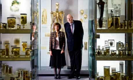 How an Irish giant and an 18th-century surgeon could help people with growth disorders | Health & wellbeing | The Guardian