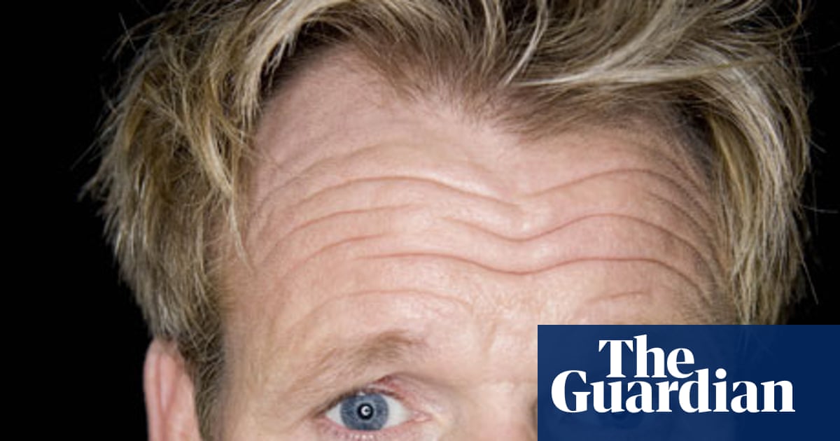Hair Apparent How Transplants Are Beating Baldness Men S Health The Guardian