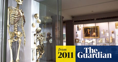 Royal College Of Surgeons Rejects Call To Bury Skeleton Of Irish Giant Controversies The Guardian Royal College Of Surgeons Rejects Call To Bury Skeleton Of Irish Giant Controversies The Guardian