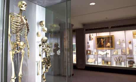 Royal College Of Surgeons Rejects Call To Bury Skeleton Of Irish Giant Controversies The Guardian Royal College Of Surgeons Rejects Call To Bury Skeleton Of Irish Giant Controversies The Guardian