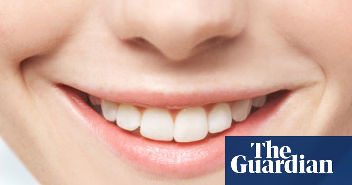 The inside track . . . on teeth whitening | Life and style ...