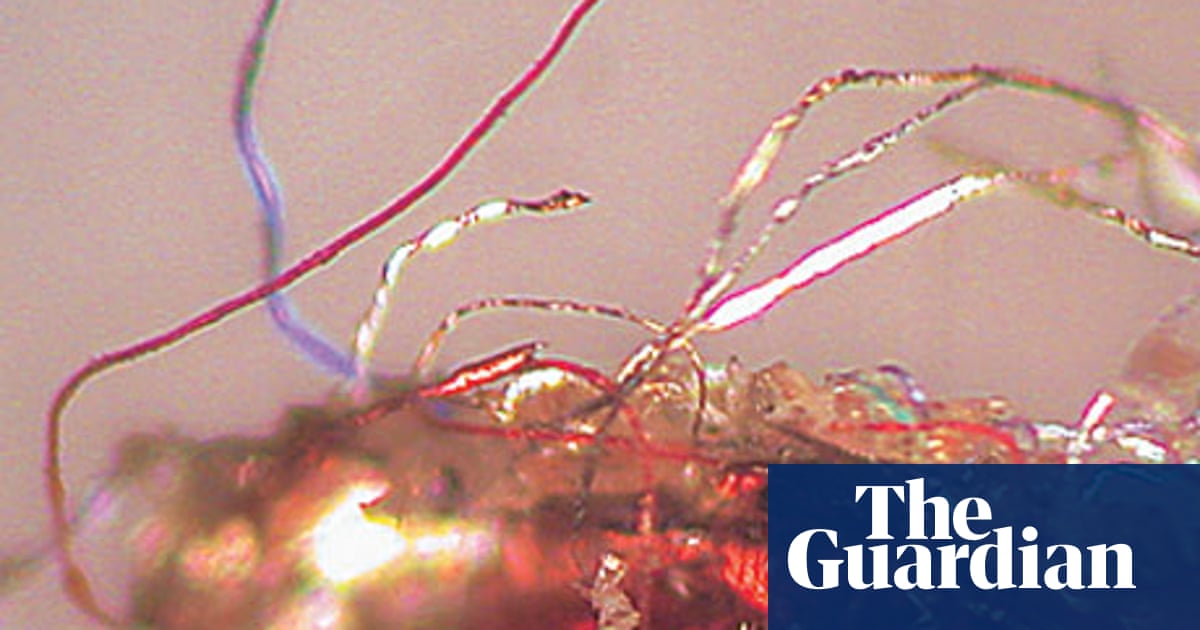 Morgellons A Hidden Epidemic Or Mass Hysteria Life And Style