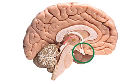 The pituitary gland (circled)