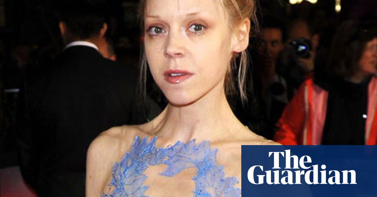 Antonia Campbell Hughes Can Actors Lose Too Much Weight For