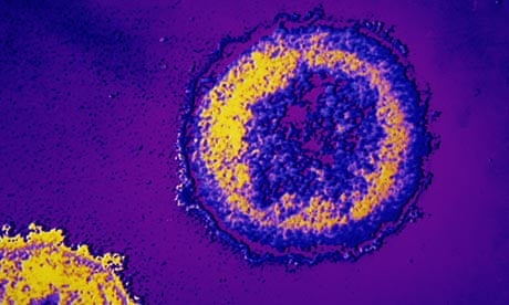 A microscopic HIV virus