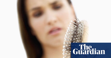 Female hair loss: causes and treatment | Health & wellbeing | The Guardian