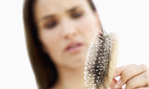 Female Hair Loss Causes And Treatment Life And Style The Guardian