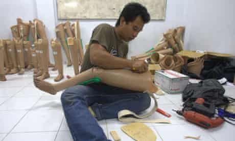 Prostheses in Banda Aceh