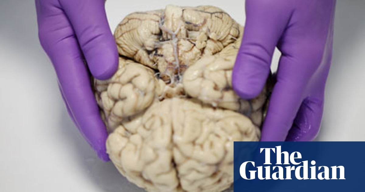 Dissecting brains is pretty intense' | Science | The Guardian