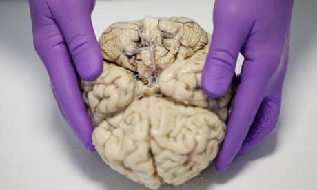 Steve Gentleman prepares to dissect a human brain.