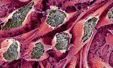 Stem cells and nanotechnology