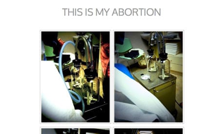 photos a woman took while she was undergoing an abortion (thisismyabortion.com)