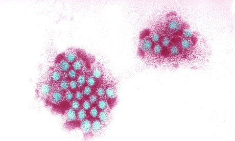 The norovirus … shown slightly larger than actual size.