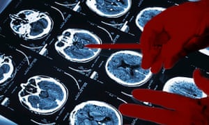 how to write a science news story based on a research paper