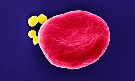 Staphylococcus aureus bacteria on a red blood cell.