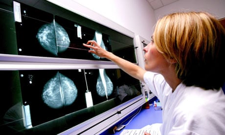 radiologist examines mammograms on a lightbox