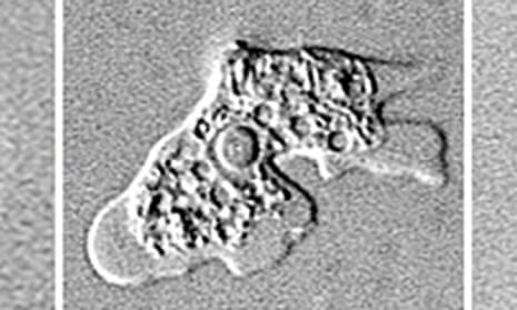 Naegleria fowleri amoeba under a microscope