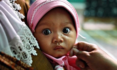 Face of circumcised baby, Indonesia
