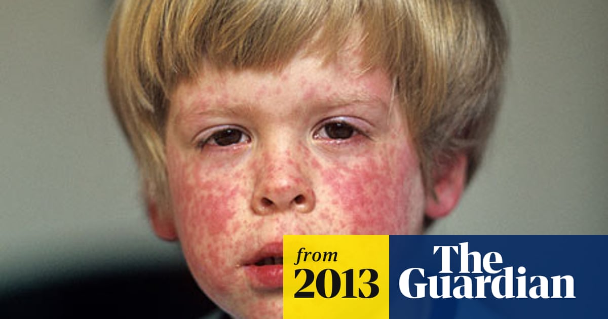 Measles Outbreaks Hit 18 year High As Effects Of MMR Scandal Are Felt Measles outbreaks hit 18 year high as effects of mmr scandal are felt
