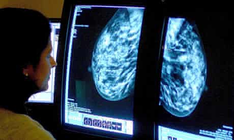 Breast cancer spread test. A consultant analysing a mammogram.
