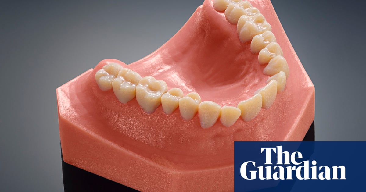 The Latest Advance In 3d Printing Replacement Teeth Technology
