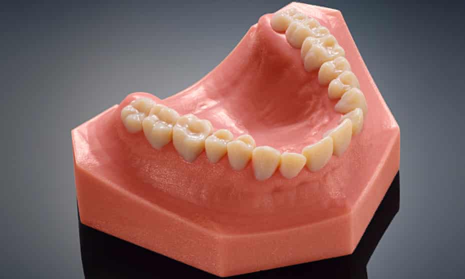 3D-printed teeth