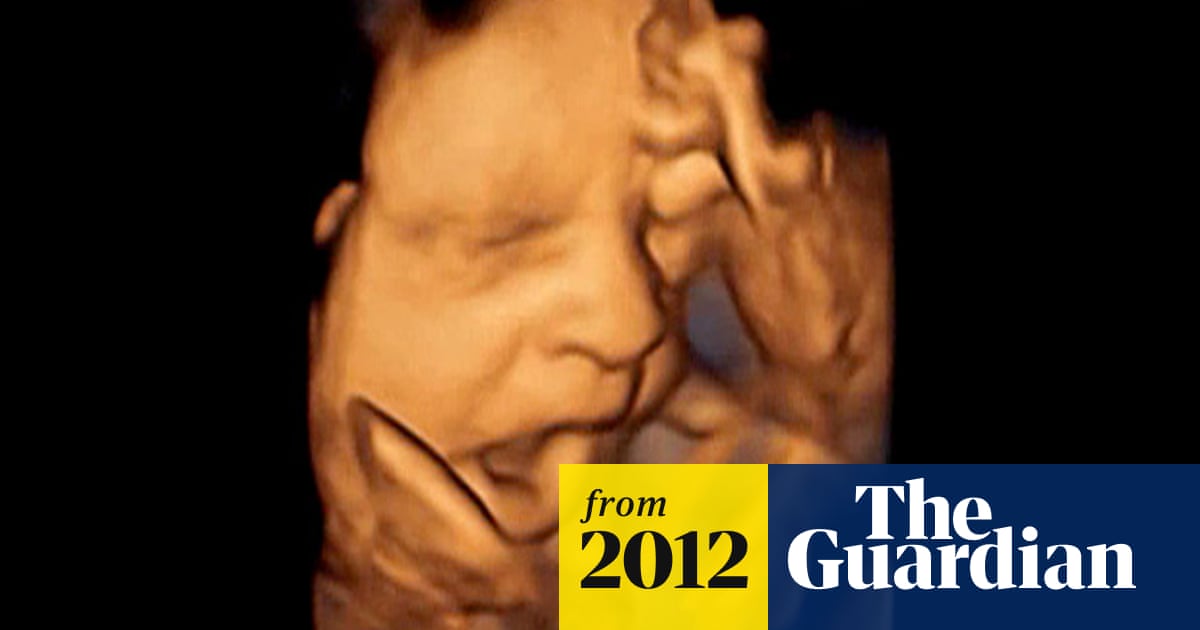 Yawning In Womb Could Be Used As Baby Health Indicator Pregnancy The Guardian Yawning In Womb Could Be Used As Baby Health Indicator Pregnancy The Guardian