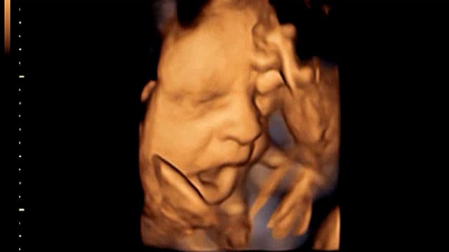 Foetus Yawns In Womb Video Science The Guardian Foetus Yawns In Womb Video Science The Guardian