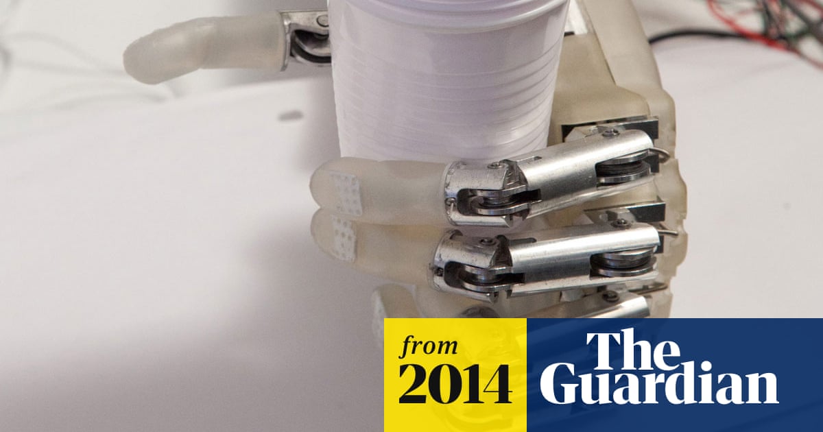 Bionic hand gives amputee real feeling – video report